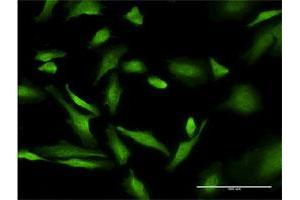 Immunofluorescence (IF) image for anti-Purine-Rich Element Binding Protein A (PURA) (AA 183-292) antibody (ABIN519546)