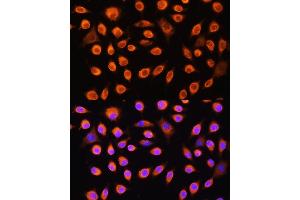 Immunofluorescence analysis of L929 cells using GNAS Rabbit pAb (ABIN6127959, ABIN6141213, ABIN6141214 and ABIN6221191) at dilution of 1:100. (GNAS antibody  (AA 1-394))
