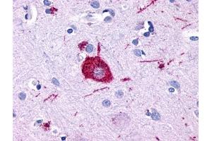 Immunohistochemical staining of Brain (Neuron) using anti- GPR116 antibody ABIN122116 (G Protein-Coupled Receptor 116 antibody  (Cytoplasmic Domain))