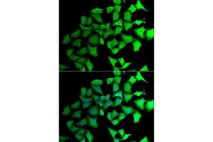 Immunofluorescence analysis of HeLa cells using TALDO1 antibody. (TALDO1 antibody  (AA 1-337))