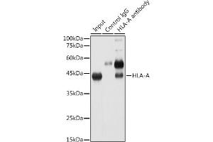 Immunoprecipitation analysis of 300 μg extracts of HeLa cells using 3 μg HLA-A antibody (ABIN7268366). (HLA-A antibody)