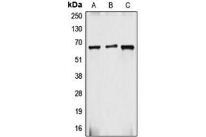 Western blot analysis of gp91 phox expression in HepG2 (A), Caco2 (B), MCF7 (C) whole cell lysates. (CYBB antibody  (C-Term))