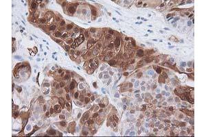 Image no. 3 for anti-Hydroxyprostaglandin Dehydrogenase 15-(NAD) (HPGD) antibody (ABIN1496363) (HPGD antibody)