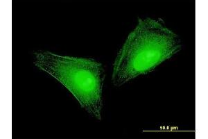 Immunofluorescence of monoclonal antibody to S100A11 on HeLa cell. (S100A11 antibody  (AA 1-105))