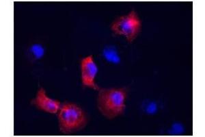 Vimentin antibody used at a dilution of 1:400 to detect COS7 cells. (Vimentin antibody  (N-Term))