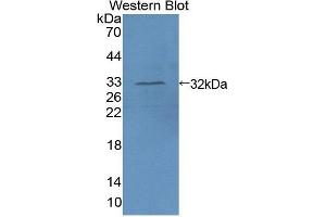 Western blot analysis of the recombinant protein. (AIM1 antibody  (AA 1502-1719))