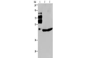 Western Blotting (WB) image for anti-Proprotein Convertase Subtilisin/kexin Type 9 (PCSK9) antibody (ABIN2433553) (PCSK9 antibody)