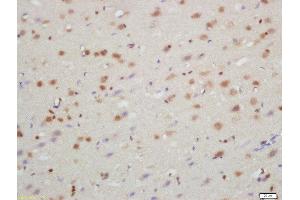 Formalin-fixed and paraffin embedded rat brain labeled with Rabbit Anti-TXNIP Polyclonal Antibody, Unconjugated  at 1:200 followed by conjugation to the secondary antibody and DAB staining (TXNIP antibody  (AA 101-200))