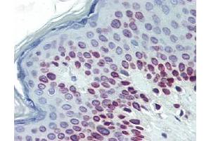 IHC Image for AP22639PU-N Human Skin (formalin-fixed, paraffin-embedded) stained with Lamin Cat 1/50 followed by biotinylated goat anti-rabbit IgG secondary antibody LS-D1, alkaline phosphatase-streptavidin and chromogen. (Lamin A/C antibody  (N-Term))