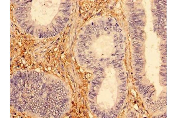 INPP5A antibody  (AA 1-409)