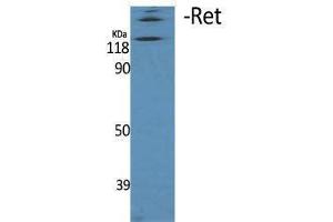 Western Blotting (WB) image for anti-Ret Proto-Oncogene (RET) (Thr77) antibody (ABIN3186734) (Ret Proto-Oncogene antibody  (Thr77))
