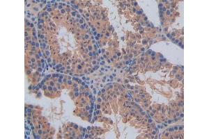 Used in DAB staining on fromalin fixed paraffin- embedded Kidney tissue (CANT1 antibody  (AA 111-403))