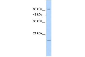 SLC13A3 antibody used at 5 ug/ml to detect target protein. (SLC13A3 antibody)