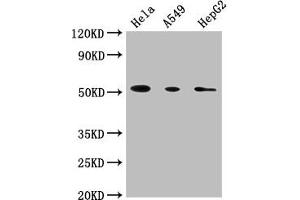 Western Blot Positive WB detected in: Hela whole cell lysate, A549 whole cell lysate, HepG2 whole cell lysate All lanes: CD14 antibody at 1:1800 Secondary Goat polyclonal to Mouse IgG at 1/10000 dilution Predicted band size: 41 kDa Observed band size: 55 kDa (CD14 antibody  (AA 20-345))