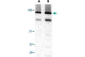 Western blot analysis of TRPC3 in human brain tissue lysate with TRPC3 polyclonal antibody  at (A) 1 and (B) 2 ug/mL . (TRPC3 antibody  (C-Term))