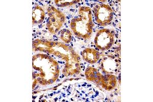 Immunohistochemical analysis of paraffin-embedded H. (SPHK1 antibody  (N-Term))