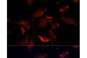 Immunofluorescence analysis of C6 cells using TYMS Polyclonal Antibody at dilution of 1:100. (TYMS antibody)