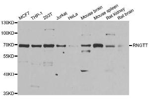 Western blot analysis of extracts of various cell lines, using RNGTT antibody. (RNGTT antibody  (AA 1-260))