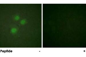 Immunofluorescence analysis of HUVEC cells, using MKI67IP polyclonal antibody .