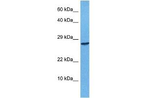 Host:  Rabbit  Target Name:  APOBEC3F  Sample Tissue:  Human 293T Whole Cell  Antibody Dilution:  1ug/ml (APOBEC3F antibody  (N-Term))