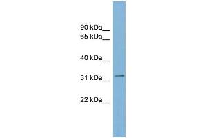 WB Suggested Anti-TMEM163 Antibody Titration:  0. (TMEM163 antibody  (Middle Region))