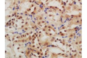 Formalin-fixed and paraffin embedded rat kidney labeled with Rabbit Anti-GLIS3 Polyclonal Antibody, Unconjugated (ABIN2174444) at 1:200 followed by conjugation to the secondary antibody and DAB staining (GLIS3 antibody  (AA 101-200))