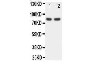 Anti-FOXP1 antibody, Western blotting Lane 1: Rat Spleen Tissue Lysate Lane 2: COLO320 Cell Lysate (FOXP1 antibody  (C-Term))