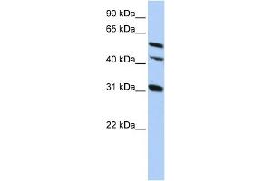 WB Suggested Anti-GJA8 Antibody Titration:  0. (GJA8 antibody  (Middle Region))