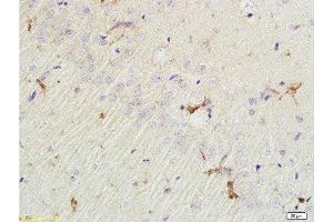 Formalin-fixed and paraffin embedded rat brain labeled with Rabbit Anti EphA7/Eph receptor A7 Polyclonal Antibody, Unconjugated  at 1:200 followed by conjugation to the secondary antibody and DAB staining (EPH Receptor A7 antibody  (AA 181-280))