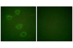 Immunofluorescence analysis of HuvEc cells, using Tyrosine Hydroxylase (Phospho-Ser19) antibody. (Tyrosine Hydroxylase antibody  (pSer19))