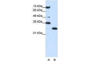 WB Suggested Anti-ANP32A Antibody Titration:  0. (PHAP1 antibody  (Middle Region))