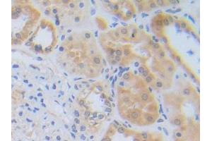 DAB staining on IHC-P; Samples: Human Kidney Tissue (RNF112 antibody  (AA 73-322))