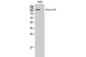 Western Blotting (WB) image for anti-Ataxin 2-Like (ATXN2L) (Internal Region) antibody (ABIN3180503)