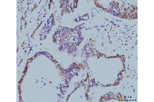 IHC analysis of Cyclophilin E/PPIE using anti-Cyclophilin E/PPIE antibody (ABIN7599243). (PPIE antibody  (AA 1-301))