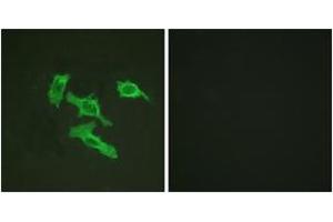 Immunofluorescence analysis of HepG2 cells, using EGFR (Ab-1016) Antibody. (EGFR antibody  (AA 986-1035))