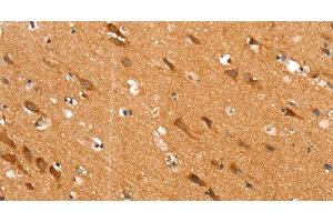 Immunohistochemistry of paraffin-embedded Human brain tissue using SLC25A12 Polyclonal Antibody at dilution 1:30 (SLC25A12 antibody)