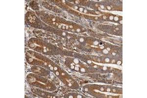 Immunohistochemical staining of human small intestine with VEZT polyclonal antibody  shows strong cytoplasmic positivity in glandular cells at 1:20-1:50 dilution. (VEZT antibody)