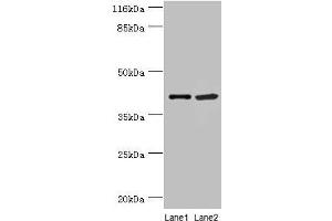 Western blot All lanes: NUDCD3 antibody at 5 μg/mL Lane 1: 293T whole cell lysate Lane 2: Hela whole cell lysate Secondary Goat polyclonal to rabbit IgG at 1/10000 dilution Predicted band size: 41 kDa Observed band size: 41 kDa (NUDCD3 antibody  (AA 142-361))