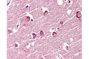 Anti-GPR119 antibody IHC of human brain, cortex. (G Protein-Coupled Receptor 119 antibody  (Cytoplasmic Domain))