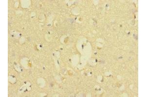 Immunohistochemistry of paraffin-embedded human brain tissue using ABIN7147143 at dilution of 1:100 (CD226 antibody  (AA 19-254))
