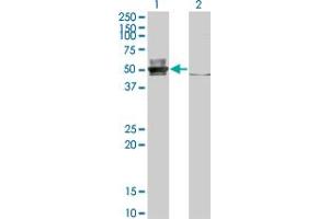 Western Blot analysis of EPSTI1 expression in transfected 293T cell line by EPSTI1 monoclonal antibody (M01), clone 2A8. (EPSTI1 antibody  (AA 1-100))