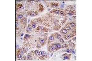 Image no. 1 for anti-Farnesyl Diphosphate Synthase (FDPS) (Middle Region) antibody (ABIN357714)