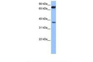 Image no. 1 for anti-Zinc Finger, CCHC Domain Containing 12 (ZCCHC12) (AA 94-143) antibody (ABIN6739394) (ZCCHC12 antibody  (AA 94-143))