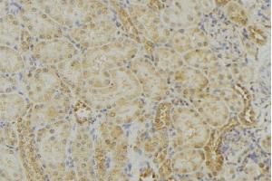 ABIN6279010 at 1/100 staining Mouse kidney tissue by IHC-P.