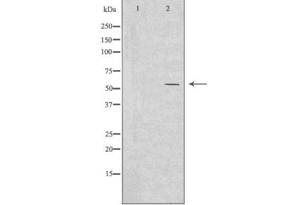 IKZF2 antibody  (Internal Region)