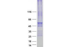 Validation with Western Blot