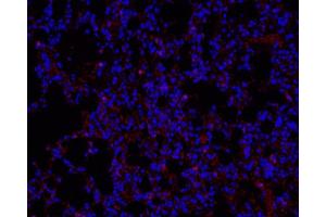 Immunofluorescence analysis of paraffin-embedded mouse Inflammatory lung using Ly6g Polyclonal Antibody at dilution of 1:200. (Ly6g antibody)
