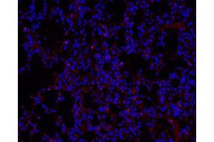 Immunofluorescence analysis of paraffin-embedded mouse Inflammatory lung using Ly6g Polyclonal Antibody at dilution of 1:200. (Ly6g antibody)