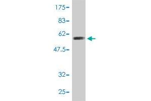 Western Blot detection against Immunogen (54. (PSMA4 antibody  (AA 1-261))