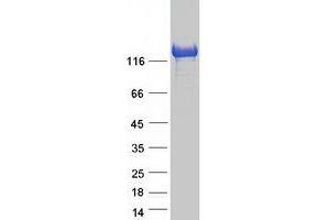 Validation with Western Blot (IKAP/p150 Protein (Myc-DYKDDDDK Tag))